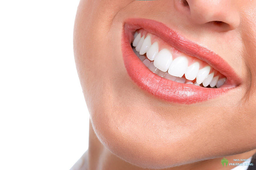 Răng sứ có cấu trúc giống như răng thật