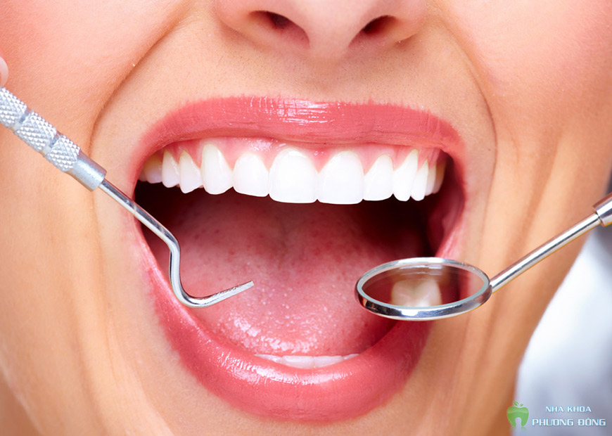 Làm răng sứ tháo lắp được chỉ định trong trường hợp mất một răng