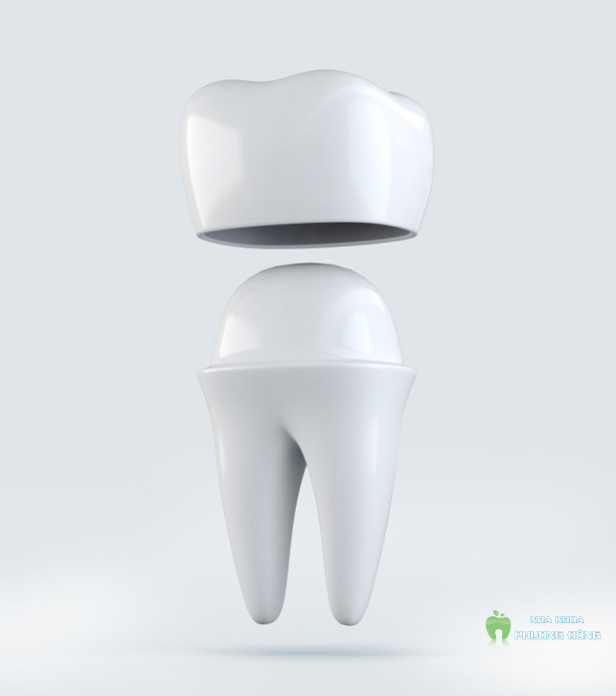 An toàn – thẩm mỹ cao – độ bền y như răng thật